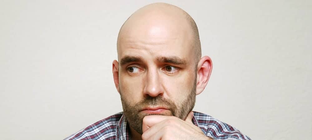 male-pattern-baldness:-everything-you-need-to-know-|-fashionbeans