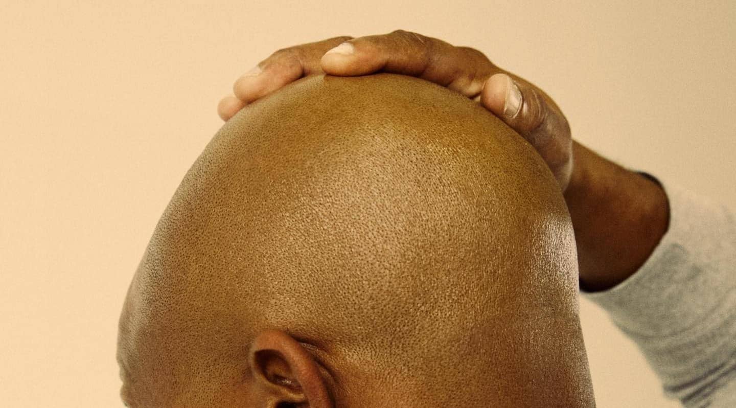 7-bald-head-care-steps-–-how-to-maintain-your-scalp-in-2024-|-fashionbeans